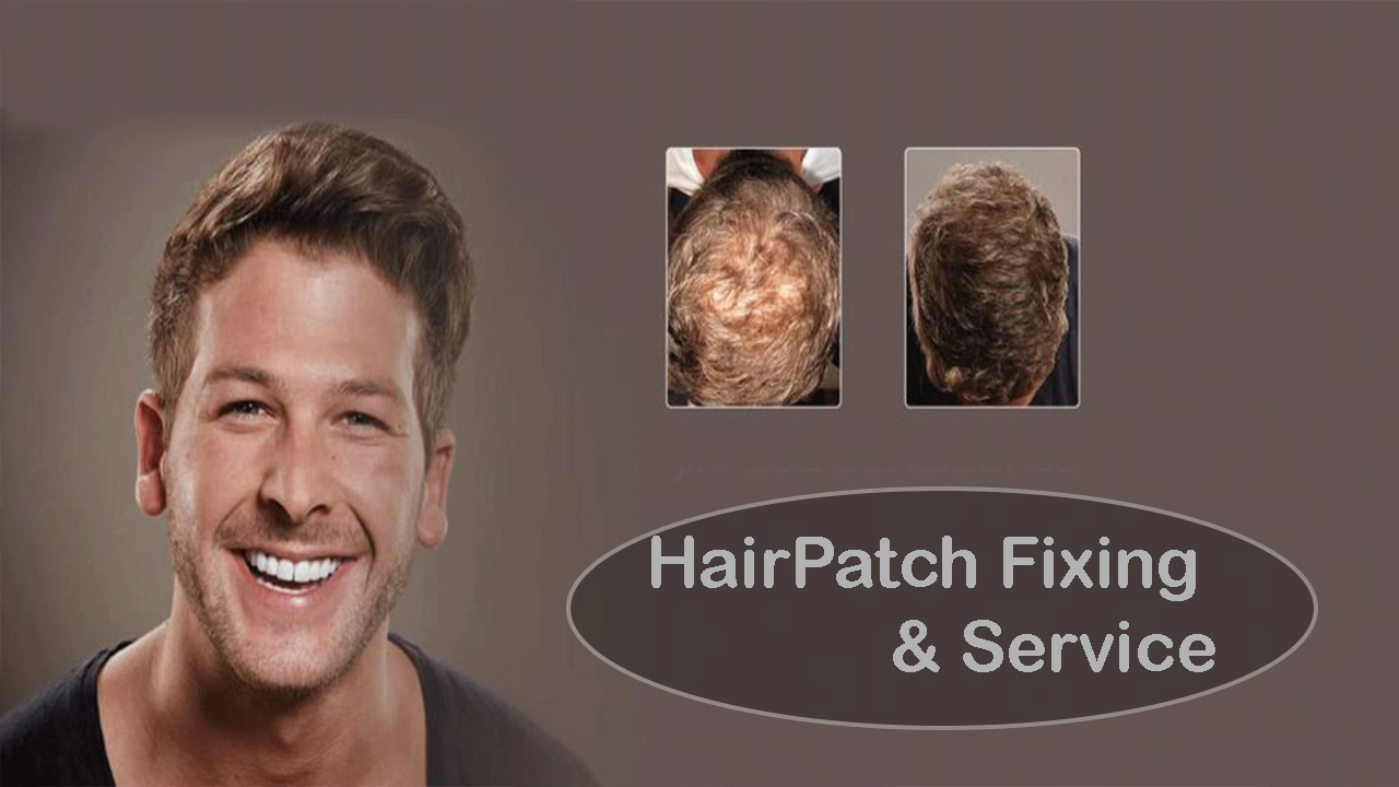 Hair Patch in Noida | 8588928272 | Hair Patch Service in Noida