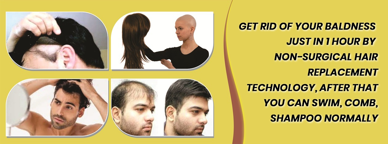 Hair Replacement in Noida | 8588928272 | Hair Replacement Clinic